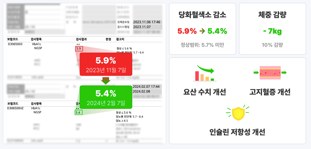 당뇨 전단계 관리